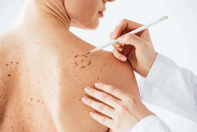 Dermatologist examining a patient’s skin